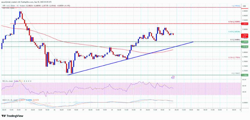 XRP价格逼近关键阻力位，未来走势或将明朗